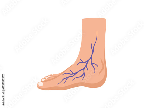 Varicose Veins Foot or Varices Foot
