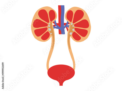 Human Kidney Stones Disease Clip Art
