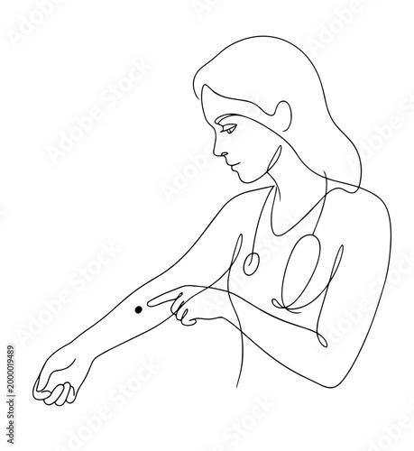 Female doctor examining skin mole line art. Dermatology and healthcare concept. Continuous one line vector illustration