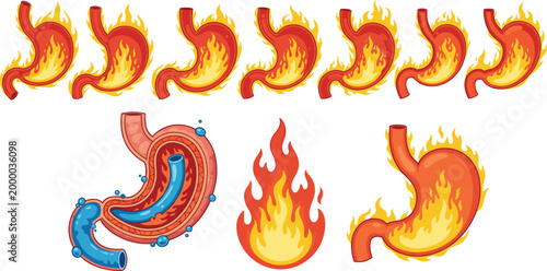 Fire Flame Collection Featuring Cartoon and Realistic Burning Fire Elements with Dynamic Shapes for Heat, Danger, Energy, and Explosion Design Concepts