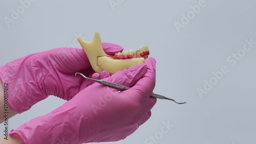 Dentist in Pink Gloves Explaining Tooth Anatomy on Jaw Model with Dental Probe