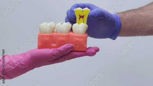 Removable Tooth Anatomy Model Demonstration in Gloves
