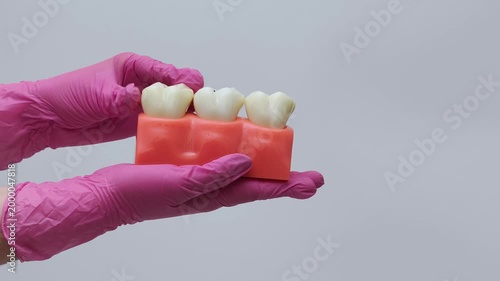 Dental Teeth Model Held by Technician in Gloves