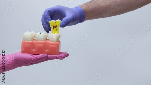 Removable Decayed Tooth Anatomy Model Demonstration