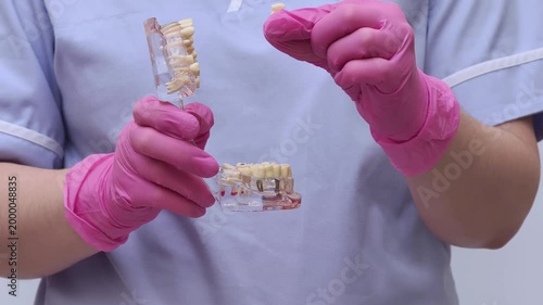 Dental Implant Bridge Models Demonstrated in Gloves