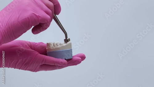 A dental technician wearing pink gloves places a crown on a plaster model of the jaw using tweezers.