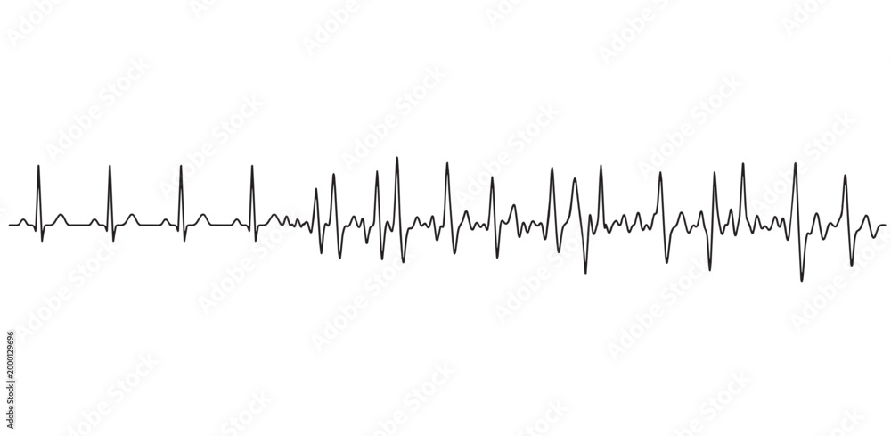 Obraz premium An image showing a rhythm disorder. Vector image. White background. It was created with artificial intelligence.