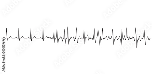 An image showing a rhythm disorder. Vector image. White background. It was created with artificial intelligence.