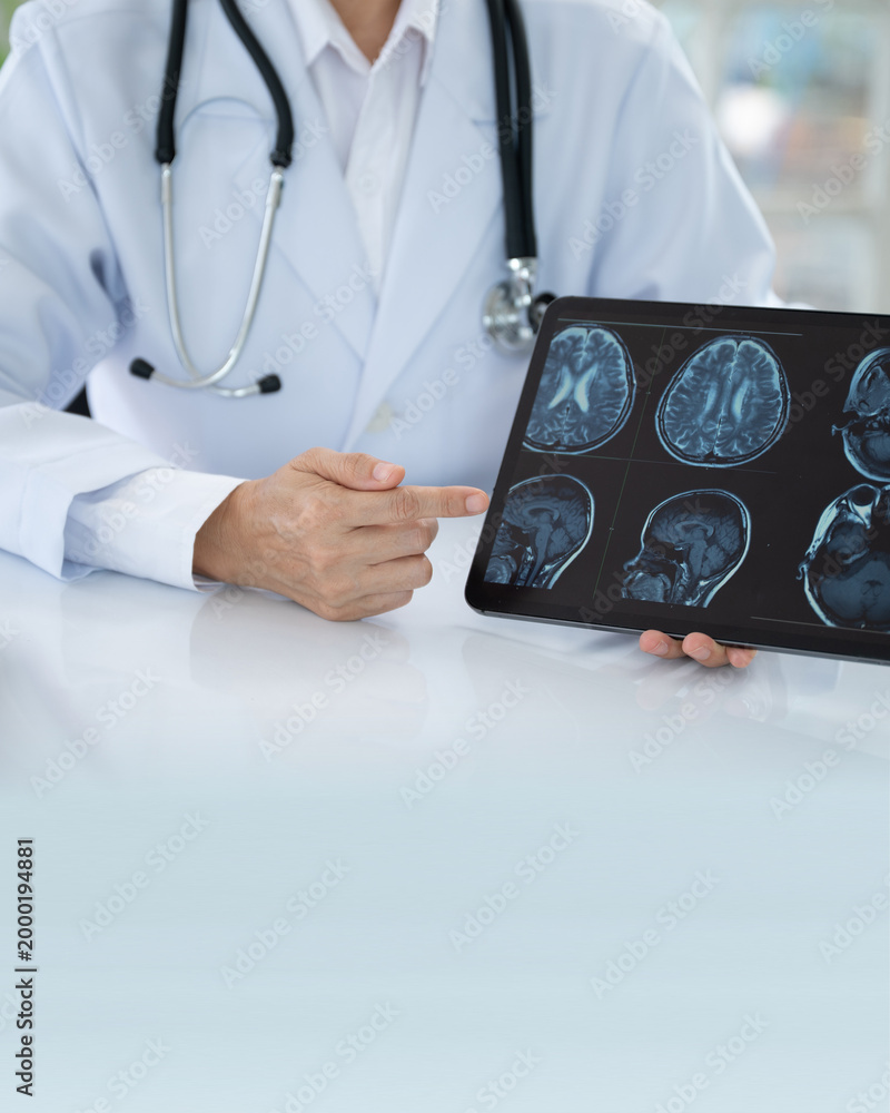 Naklejka premium Neurologist Doctor about cerebrovascular disease, migraine, Parkinson's disease, dementia and stroke at Neurology Center.