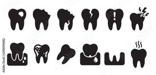 Collection of black and white vector icons illustrating various dental problems and tooth decay, useful for medical and educational contexts.