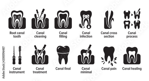 A collection of black and white vector icons illustrates the stages and aspects of root canal dental treatment, from infection to healing.