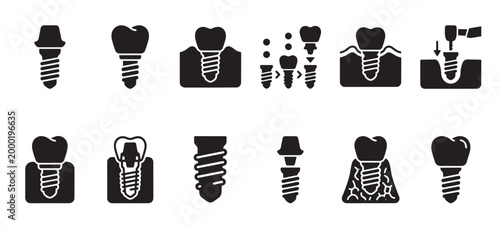 A collection of black and white icons illustrating different stages and types of dental implants, perfect for medical or dental design concepts.