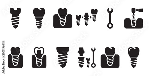 Collection of black silhouette icons representing dental implants, screws, tools, and the implantation process for dentistry and healthcare concepts.