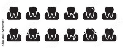 Collection of simple black icons illustrating different stages of gum disease affecting a tooth and its surrounding gums, ideal for medical and health infographics.