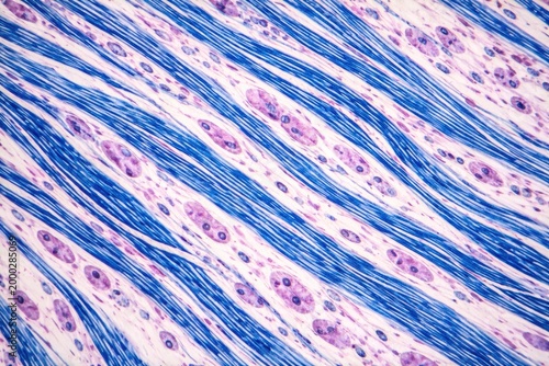 Histological image displaying longitudinal nerve fibers fixed and stained to reveal myelin sheaths