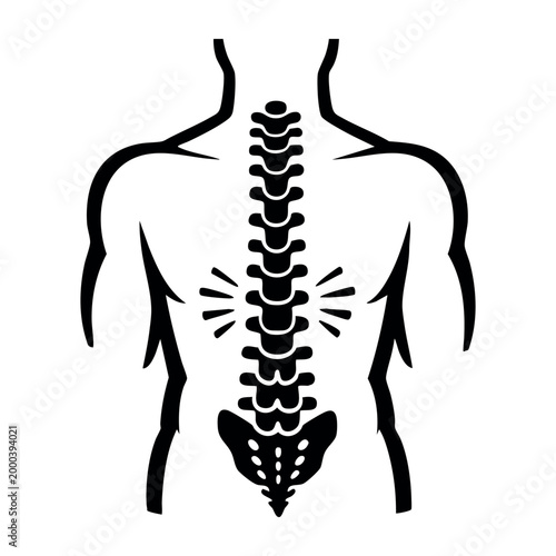 Human back showing a painful spine section. Concept of backache, healthcare, medicine, treatment, and injury