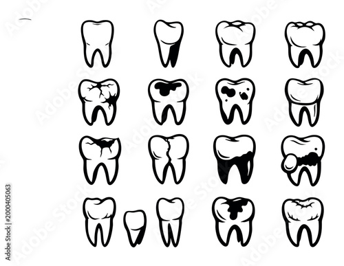 Teeth icon set representing stages of dental health, from healthy to poor oral hygiene, cavity progression, and damage