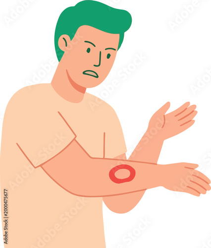 Man examining ringworm rash on arm for dermatology and medical healthcare illustration