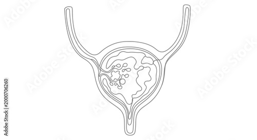 Conceptual line art illustration of the human bladder with internal details suggesting stones or deposits, representing medical or anatomical study