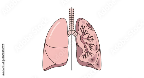 Illustration comparing a healthy lung with a diseased lung showing damage and lesions.