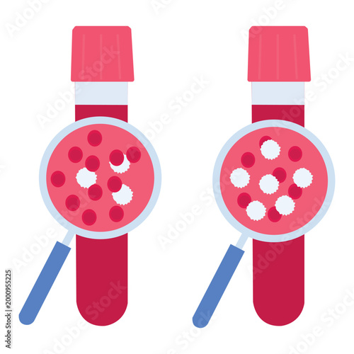 Blood sample comparison with cells under magnifying glass vector art