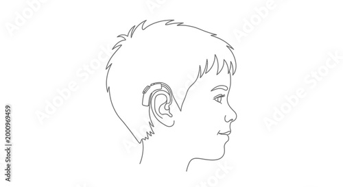 Line art illustration of a young boy wearing a hearing aid.