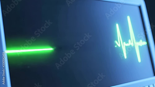 Green glowing electrocardiogram line showing normal heartbeat then flatlining to indicate cardiac arrest on a medical monitor