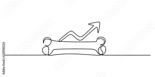 Bone shape with upward arrow graph line chart, concept of growth and success