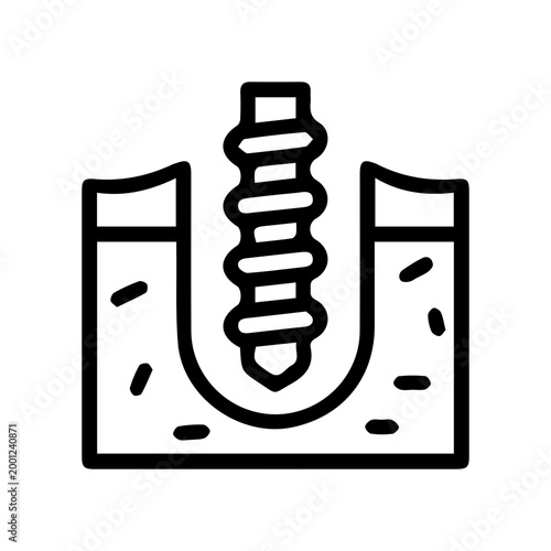 Dental Implant Illustration