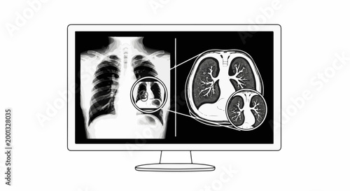 A computer screen displays a medical scan of human lungs and chest