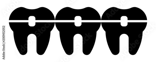 Dental braces on teeth icon. Dental bracket system vector illustration. Teeth brace alignment symbol.