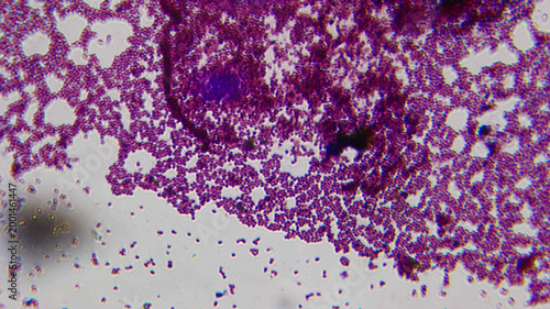 Staphylococcus Aureus Dense Grape Like Clusters Gram Stain