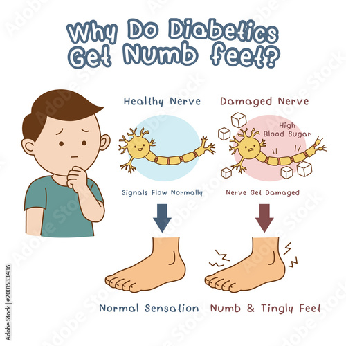 Diabetes nerve damage cause numbness in the toes, cartoon illustration on white background