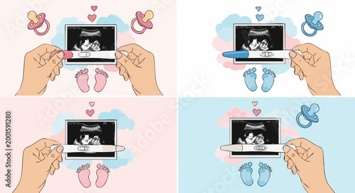 Pregnancy announcement vector set with ultrasound scan and positive test, baby gender reveal illustrations in pink and blue, maternity concept art