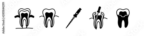 Vector set of black icons illustrating the steps of a dental root canal treatment, from infection to final crown restoration. Ideal for medical education and dentistry clinics.
