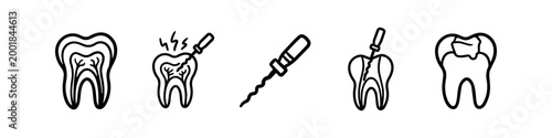 Set of dental root canal treatment icons showing tooth anatomy, endodontic procedure with files, and dental filling. Minimalist black line art for dentistry and oral health care.