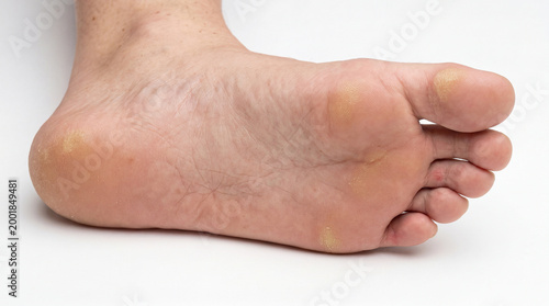 Bare foot unveils a landscape of skin, showcasing its natural resilience and points of daily stress on a pristine white stage