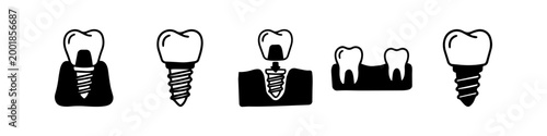 Set of minimalist black and white dental implant icons. Illustrates prosthetic crowns, bridges, and tooth restoration stages for stomatology clinic branding, oral health care, and infographics.