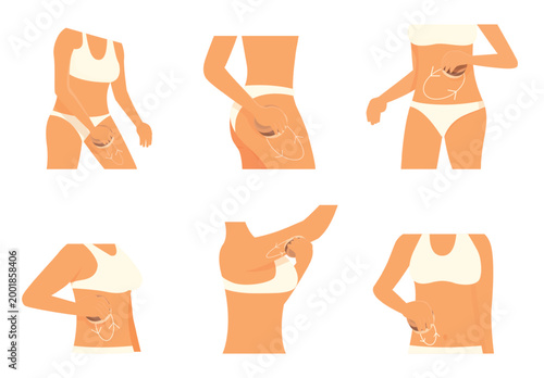 Anti cellulite massage. Body massage movements using brush. Wellness and renewing skin treatments, relaxation and lymphatic drainage, sapid vector poster