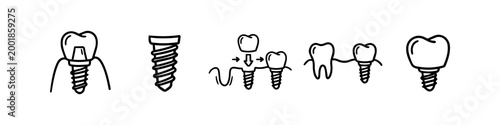 Minimalist dental implant icon set featuring black line drawings of tooth replacement, implants, screws, and prosthetic crowns on a white background for dentistry and oral health.