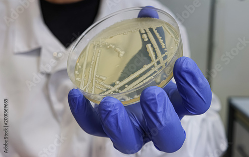 фотографія Yeast (fungi) Colonies on Agar Plate