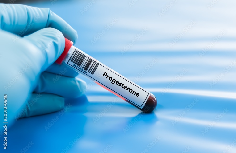 Fototapeta premium Blood sample tube for progesterone test analysis.