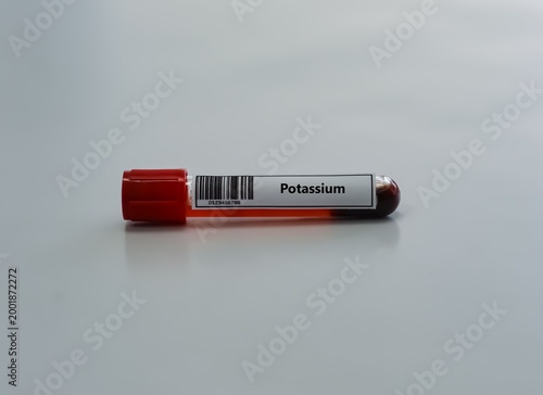 Bild auf Leinwand Blood sample tube for potassium test analysis.