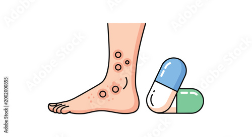 Medical illustration of a human ankle with a severe skin rash next to two medicine capsules for allergy or dermatitis treatment concepts.
