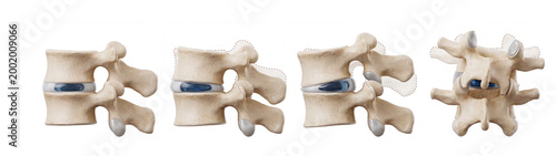 The mobility of the lumbar vertebrae. Facet joint. Medical illustration. Labeled