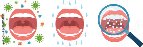 Vector illustration of oral health issues showing infection, dryness and mouth irritation in decorative design