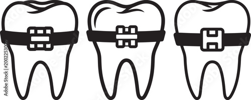 Three teeth with braces, dental care, orthodontic treatment.