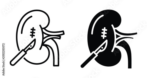 Kidney surgery icon set showing human renal organ with scalpel blade for medical operation transplant nephrectomy treatment and healthcare procedures