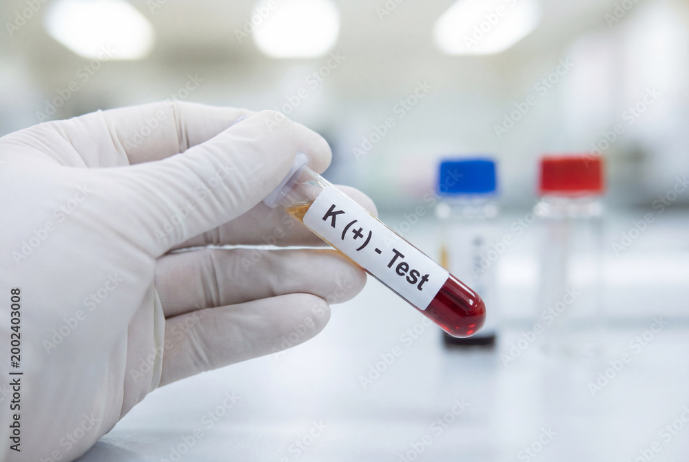 Fototapeta premium Gloved hand holding a blood sample tube for a potassium test in a medical lab