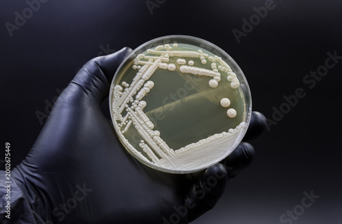 Fotografía The yeast Candida, responsible for urinary tract infections (UTIs)